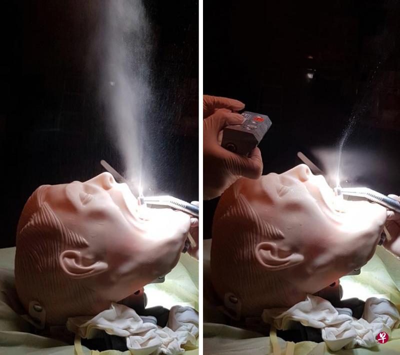 “无形口罩” 防牙科治疗时气溶胶飞散 降低冠病感染风险