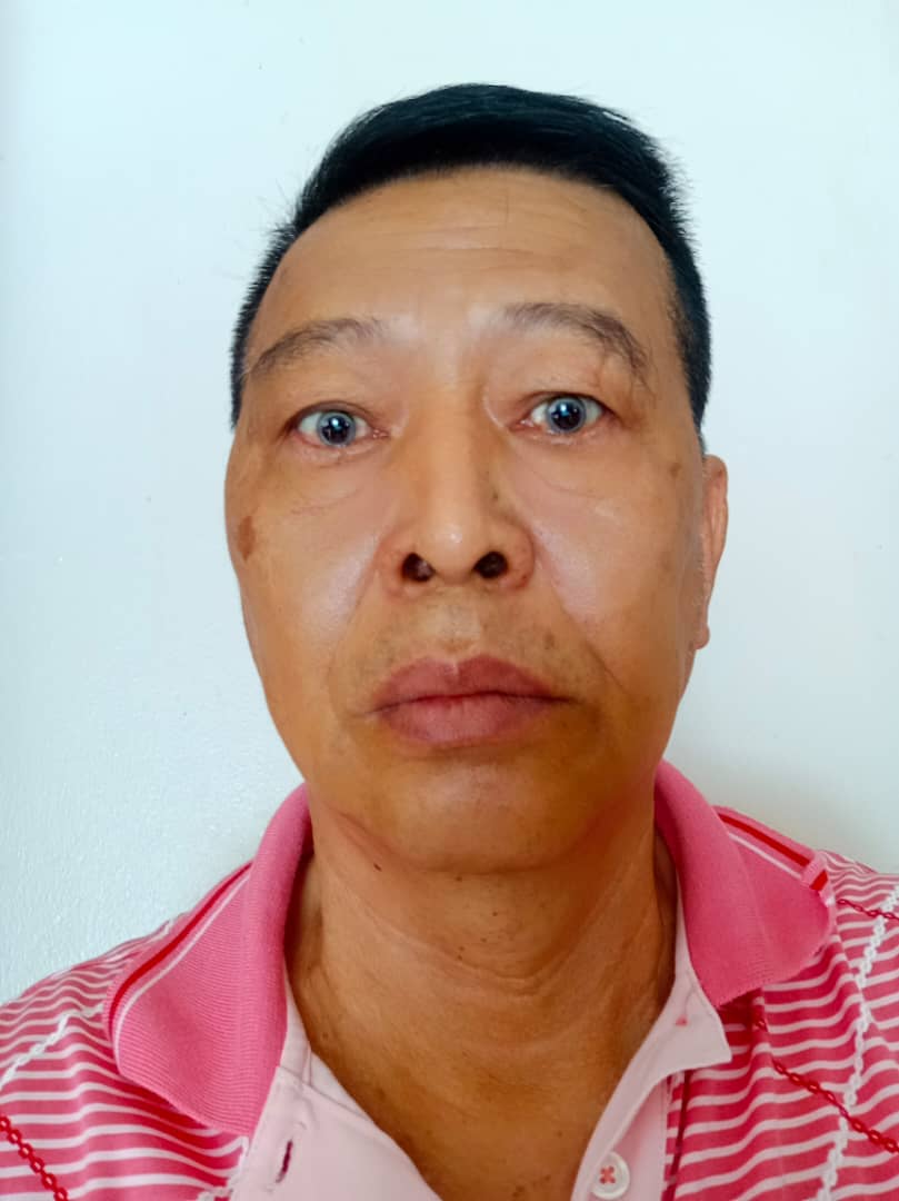 东:陈朝松呼吁遭偷果小园主报警