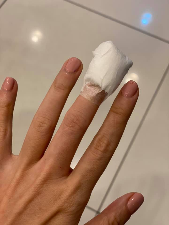 切菜伤手指溅血‧林佩琦吓坏袁锦伦