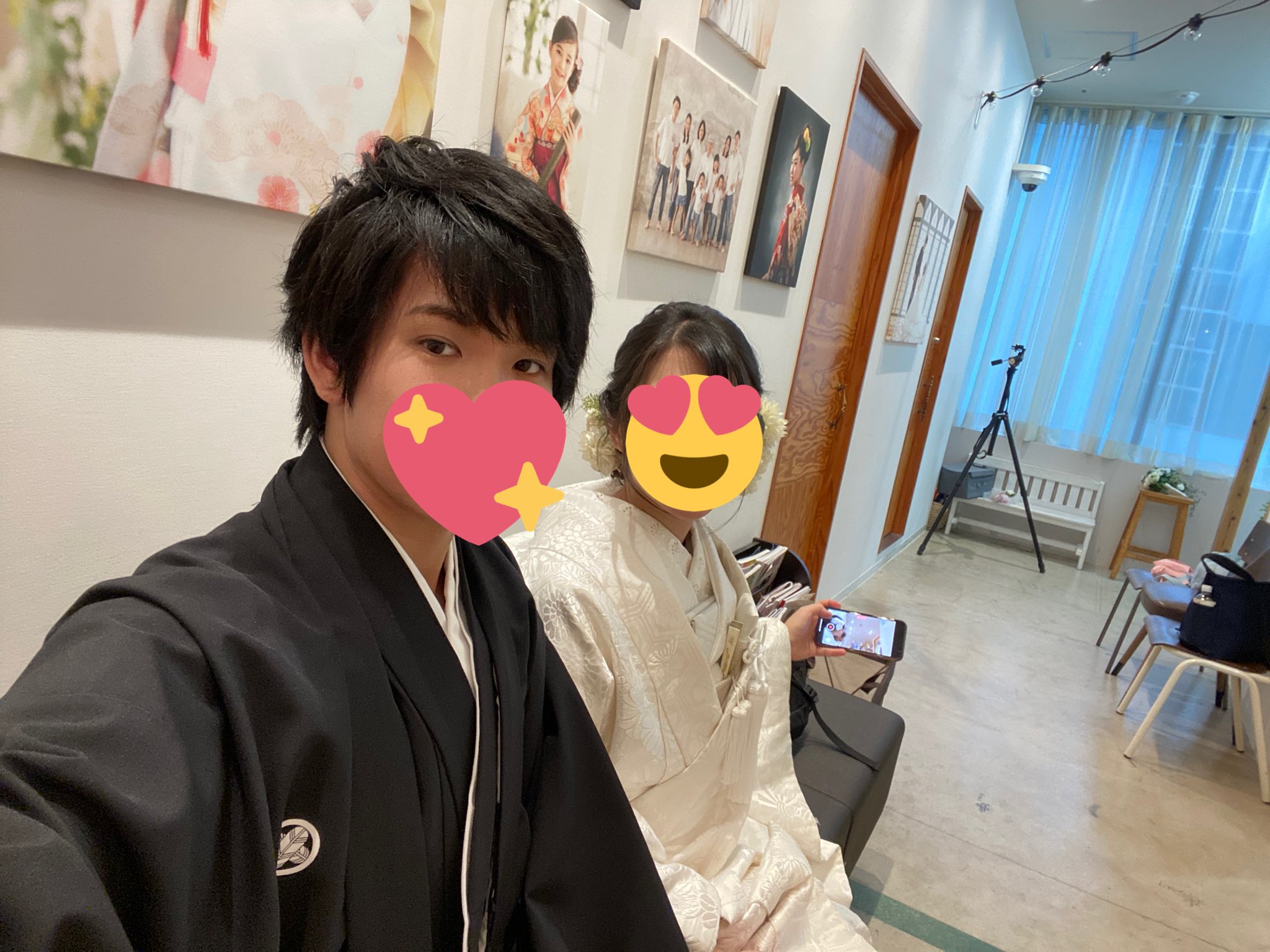 帅哥打莫德纳狂掉发 自爆百天变秃头