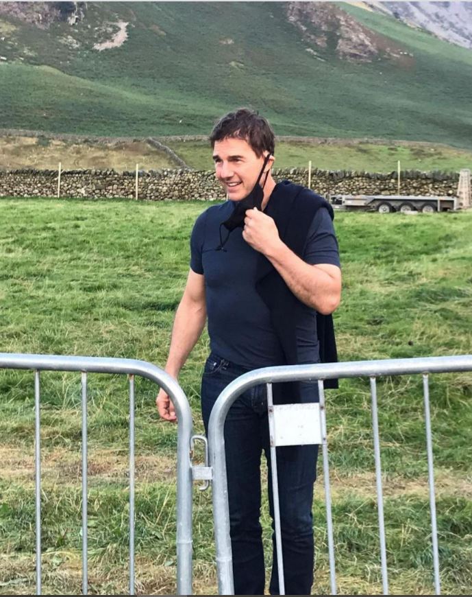 汤告鲁斯被嘲脸变形‧整形医生警告别沉迷微整