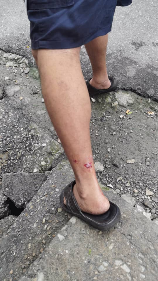 (大都会)鸿图园高空坠物意外/2图