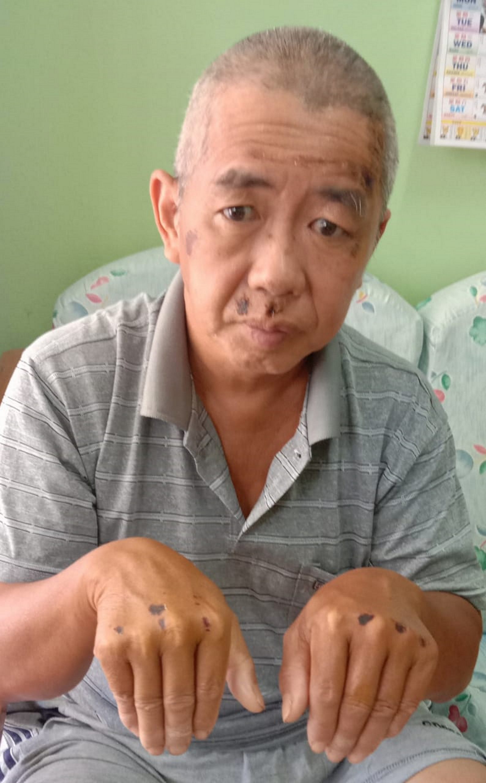 NS马口/小贩在马口大街被撞受伤,家人呼吁目击者提供线索