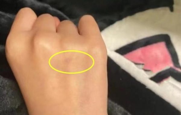 中国/传街头遭针扎恐染爱滋 网民造谣被拘