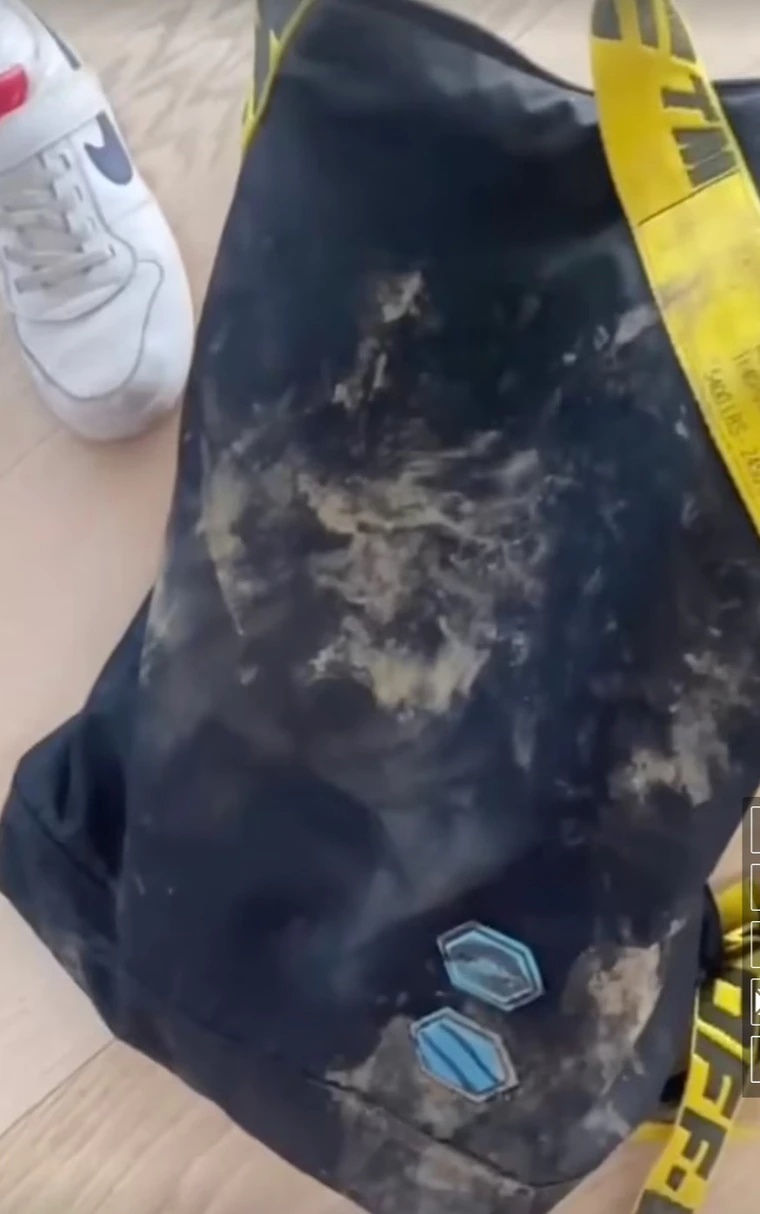 夏奇拉带8岁儿公园散步.被2野猪袭击咬烂包包