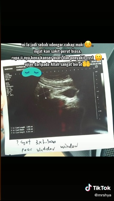 女子称爱吃辣致患癌·营养师反驳:“是吃太多垃圾食品”