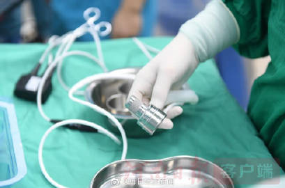 河南成功实施全球首例新型人工心脏手术