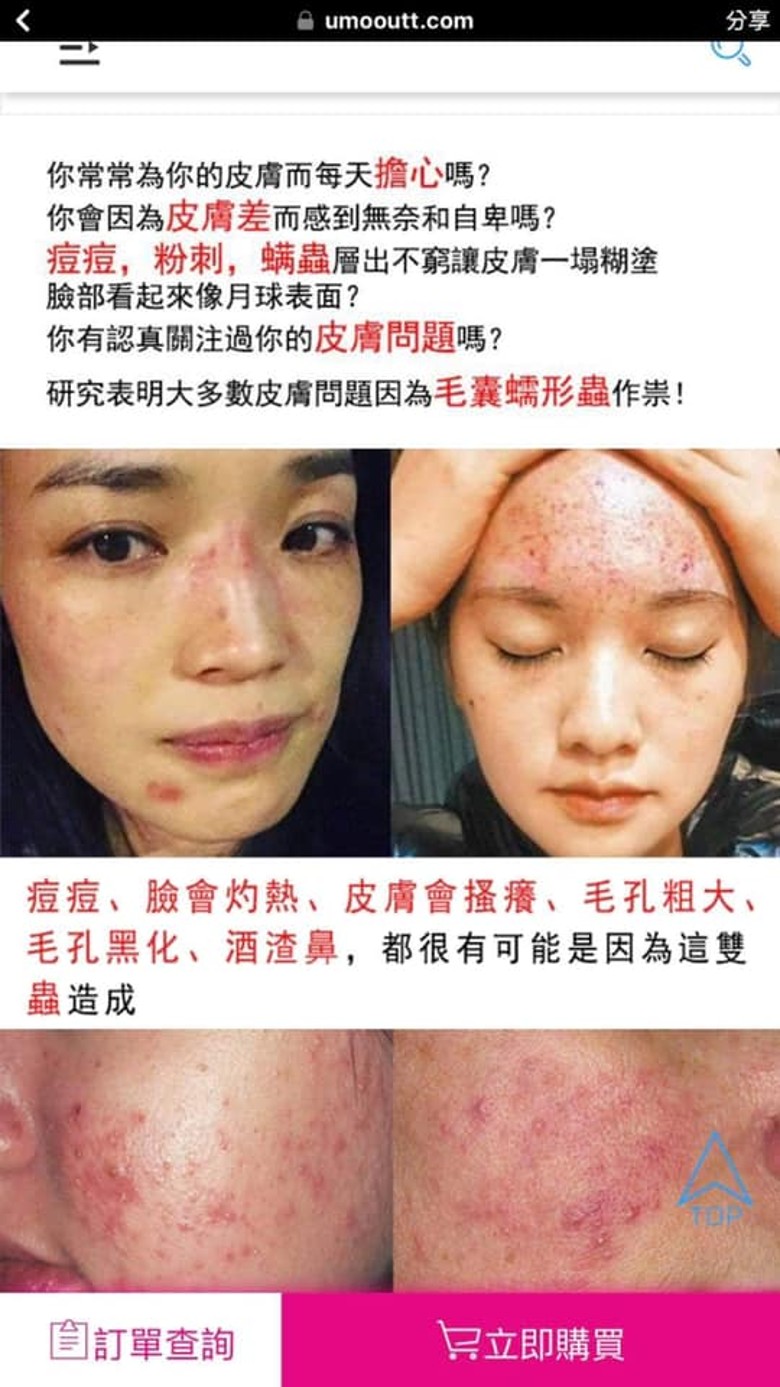 皮肤过敏照被盗用 舒淇批脸书没监管
