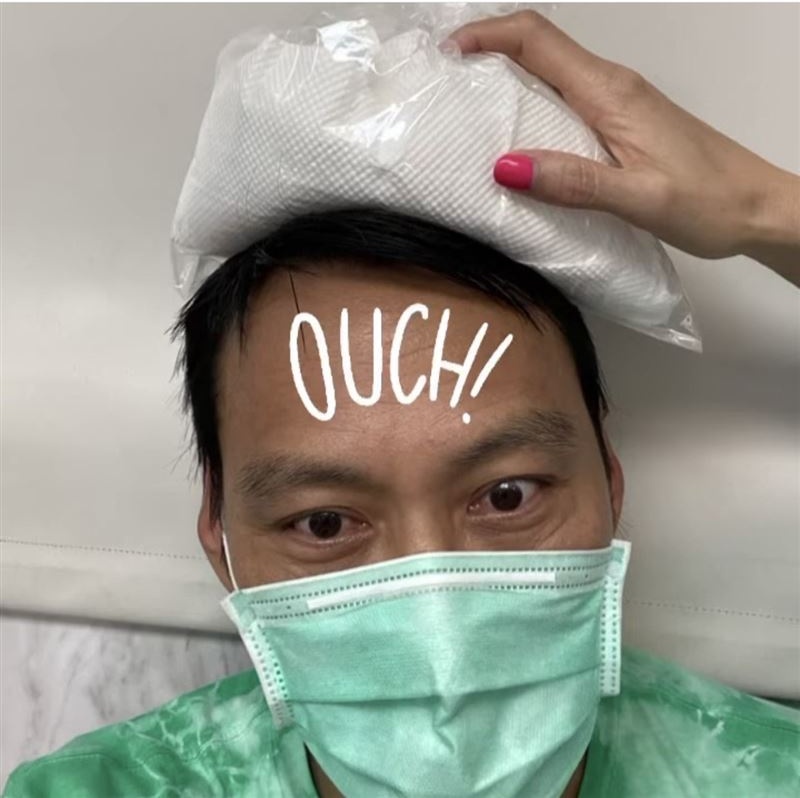 艾力克斯长太高撞破头 曝5公分惊悚血痕照