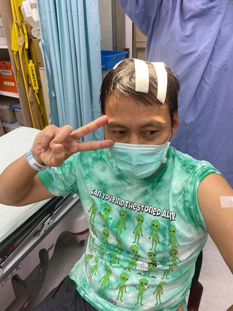 艾力克斯长太高撞破头 曝5公分惊悚血痕照