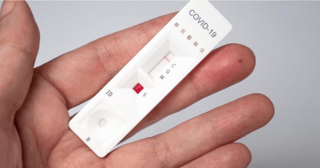 若检测呈阴性也应向当局通报,医生:因为这会影响阳性率的计算