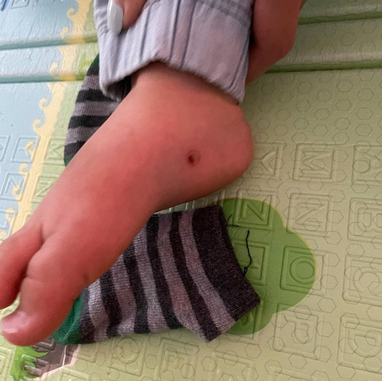 郑爽疑晒小孩手脚受伤照 暗示有人虐儿?