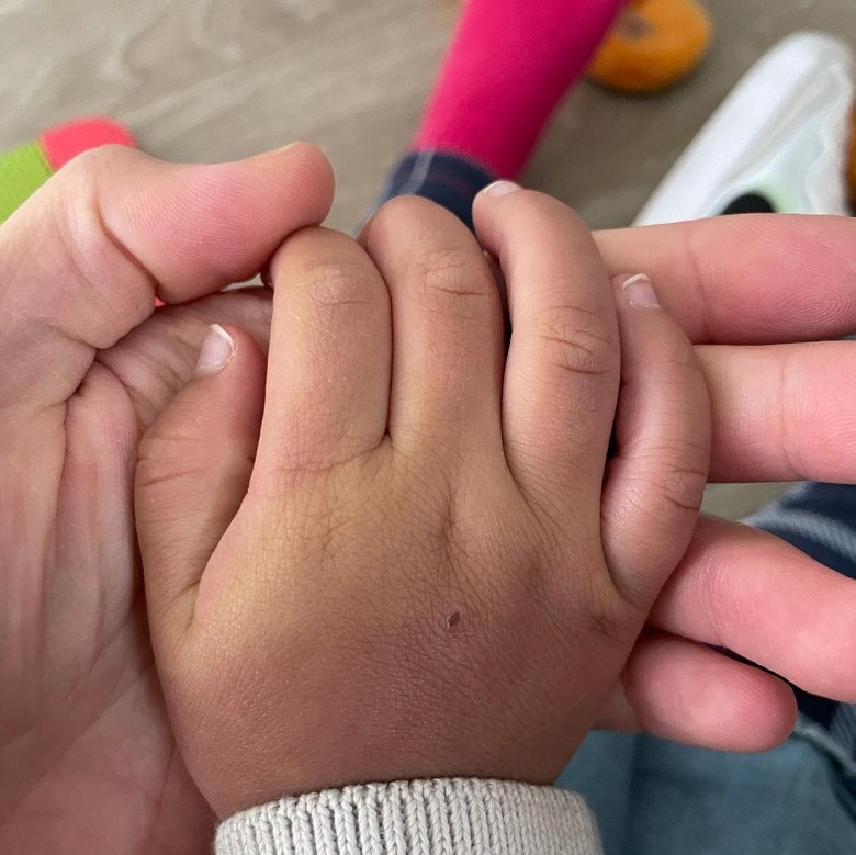 郑爽疑晒小孩手脚受伤照 暗示有人虐儿?