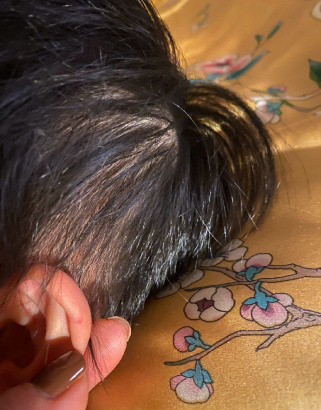 为儿子理发失手剪伤耳朵 张歆艺吓到大哭