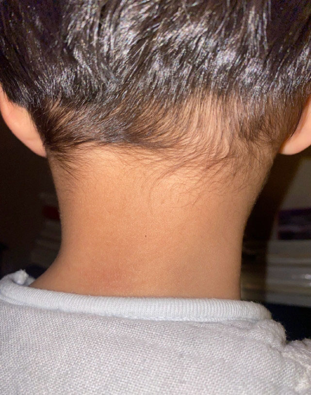 为儿子理发失手剪伤耳朵 张歆艺吓到大哭