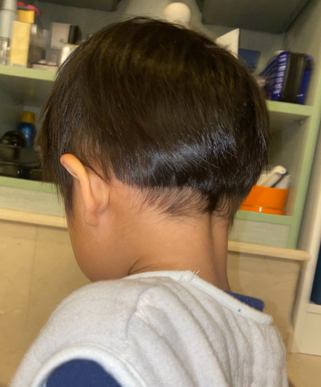 为儿子理发失手剪伤耳朵 张歆艺吓到大哭