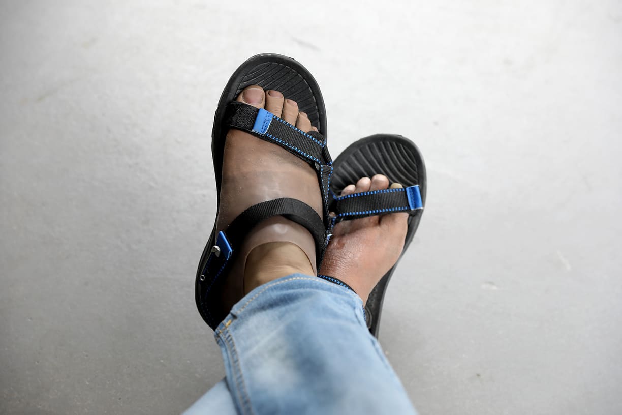 患糖尿病失右脚又肾衰竭 38岁男子:不是开玩笑