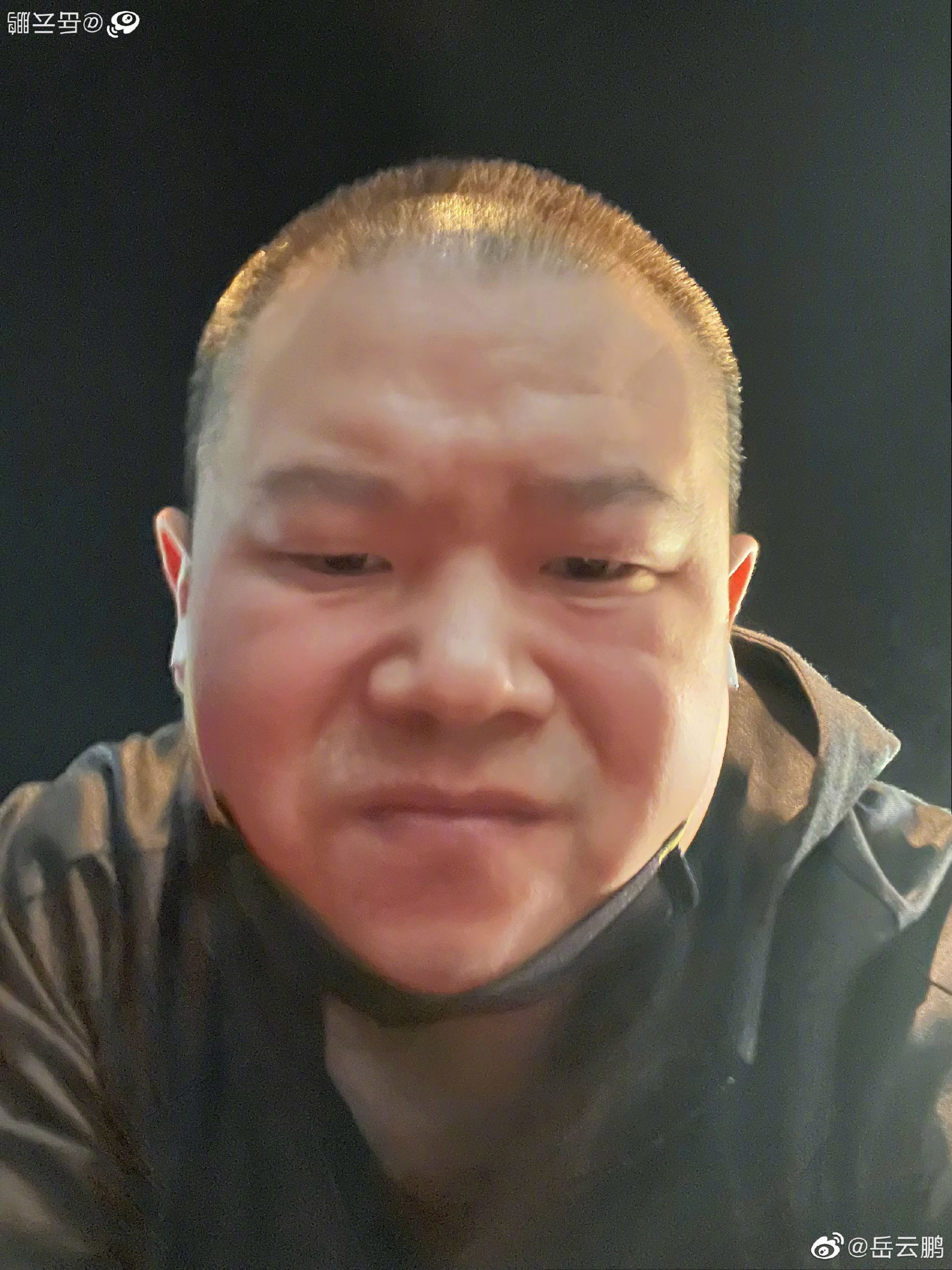 暴瘦剃光头遭疯传病危 岳云鹏:屁股长瘤