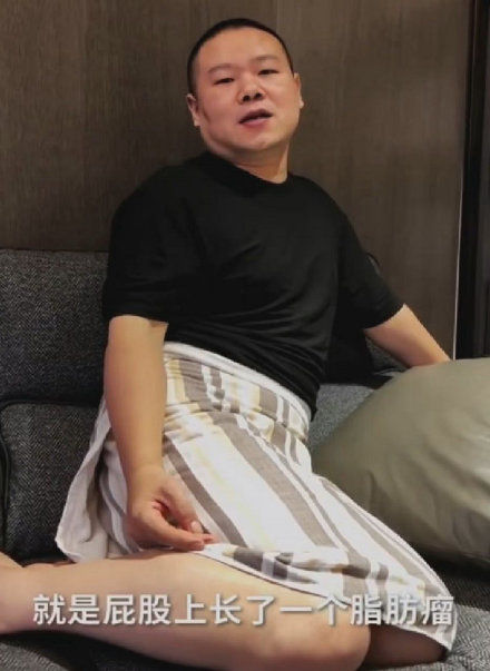 暴瘦剃光头遭疯传病危 岳云鹏:屁股长瘤