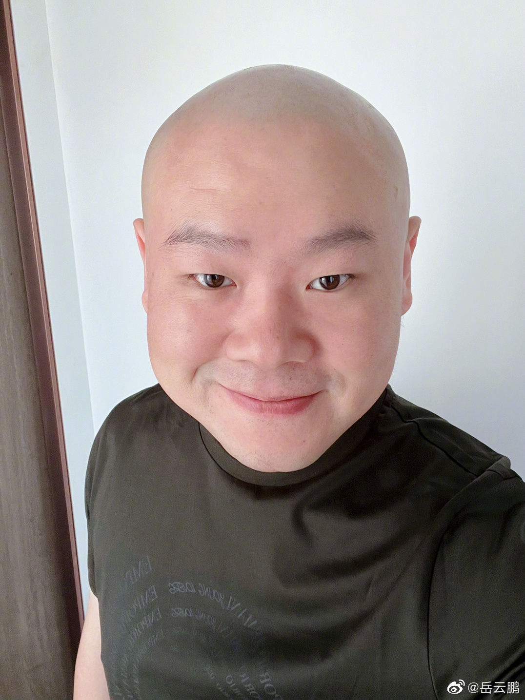 暴瘦剃光头遭疯传病危 岳云鹏:屁股长瘤