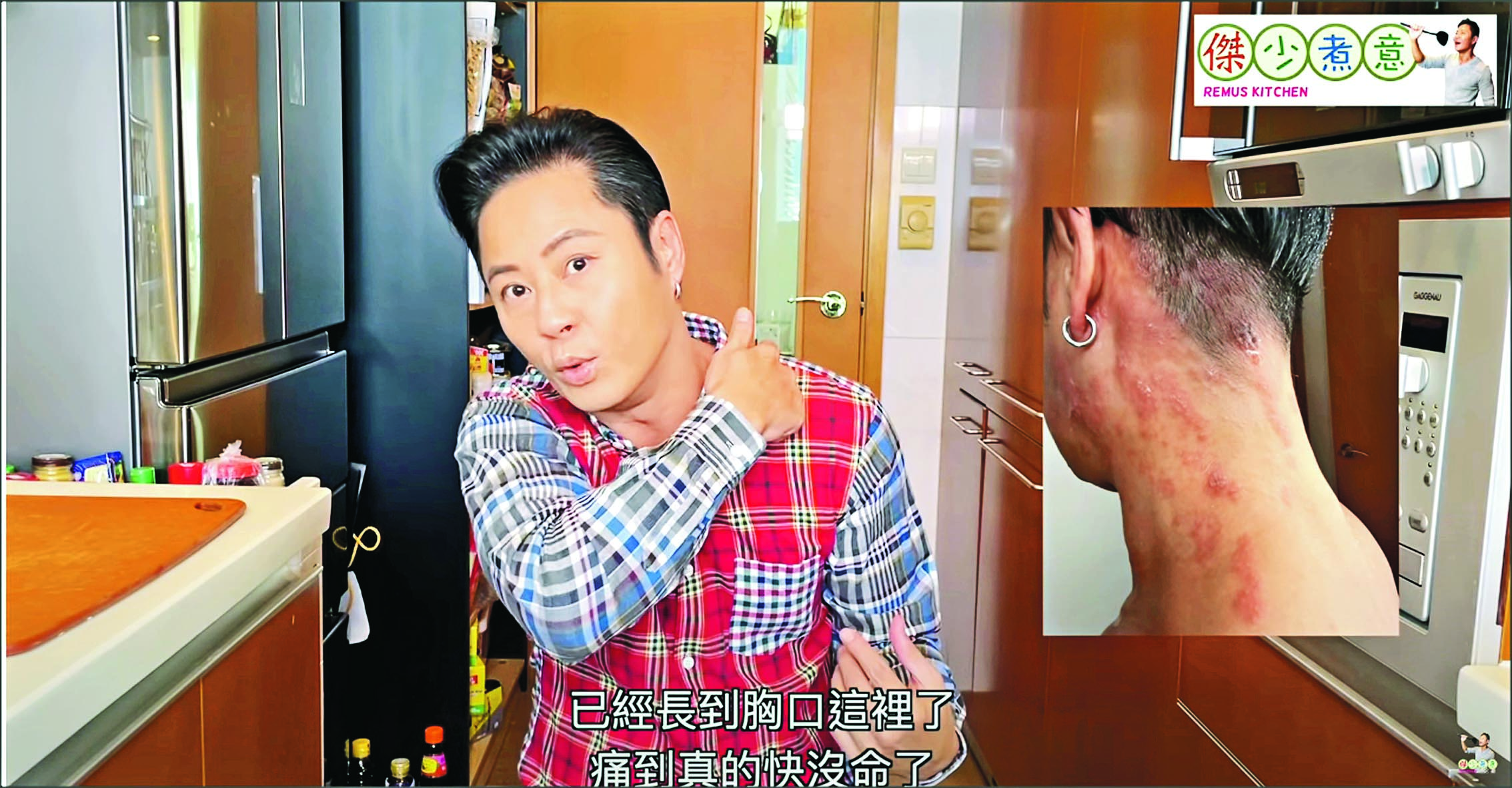 生蛇撞正8号风球  蔡一杰痛饿交迫