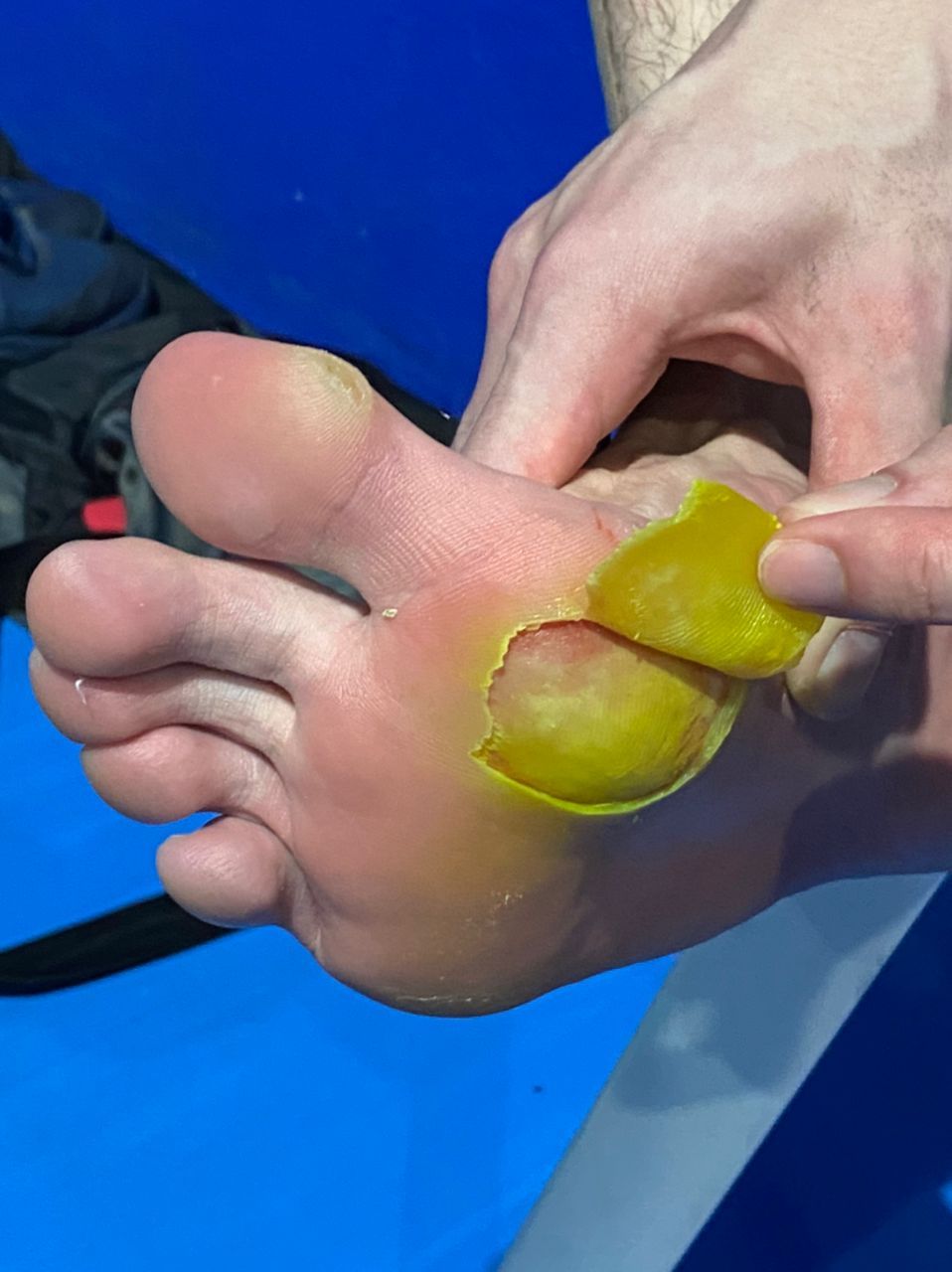 16强对维廷胡斯已受伤 叶橙旺盼梓嘉强势回归