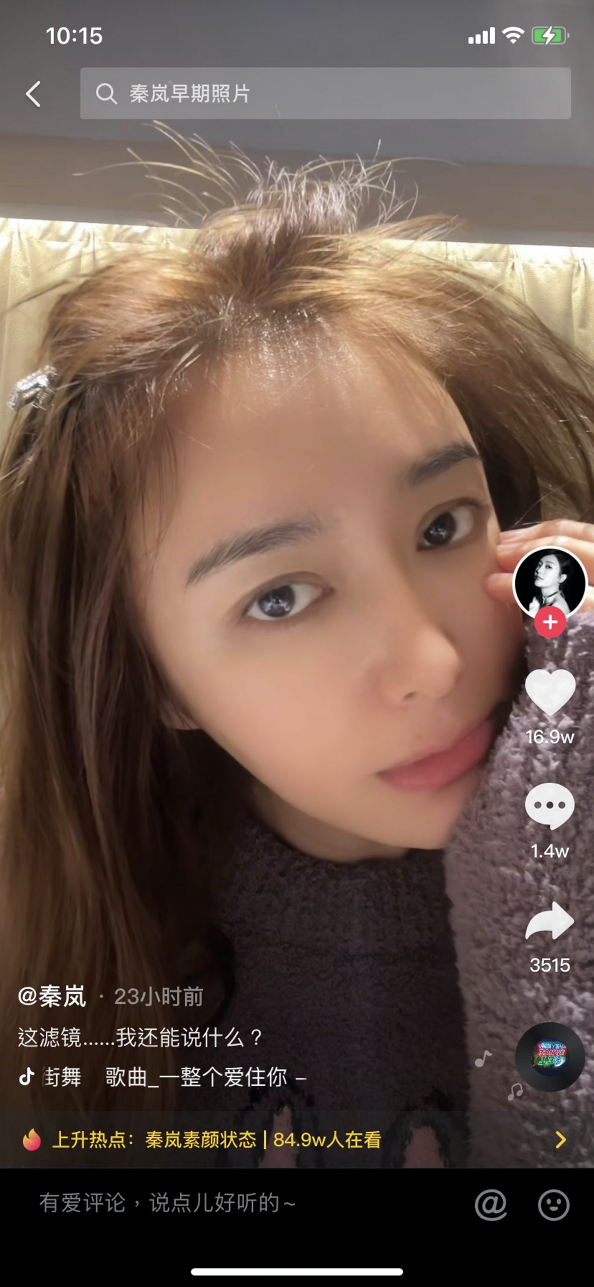 42岁秦岚素颜卖萌发际后线 网惊:女神也逃不过秃头