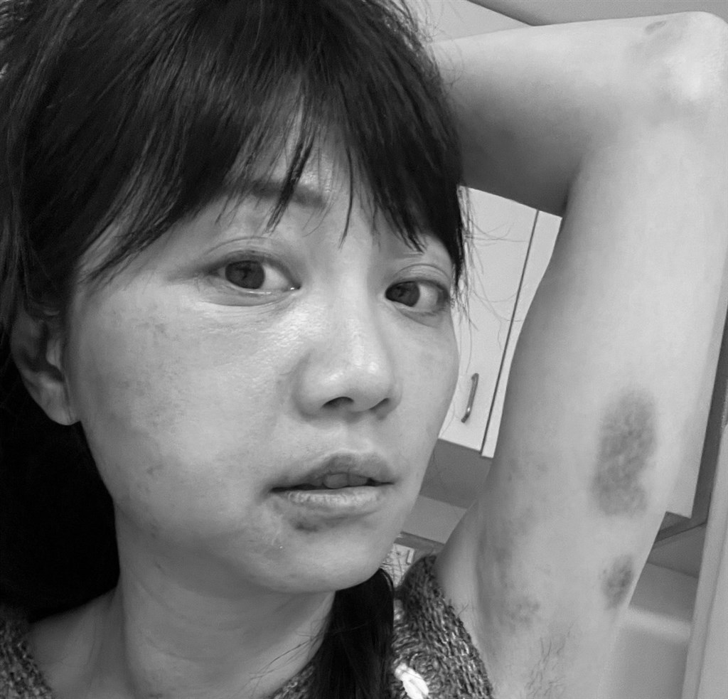 律师：高嘉瑜奄奄一息遭逼供 影片胁迫书已交检方