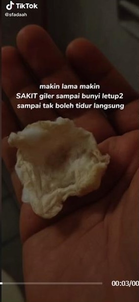 视频 | 惊！太常用棉花棒清耳屎·女子耳膜破裂