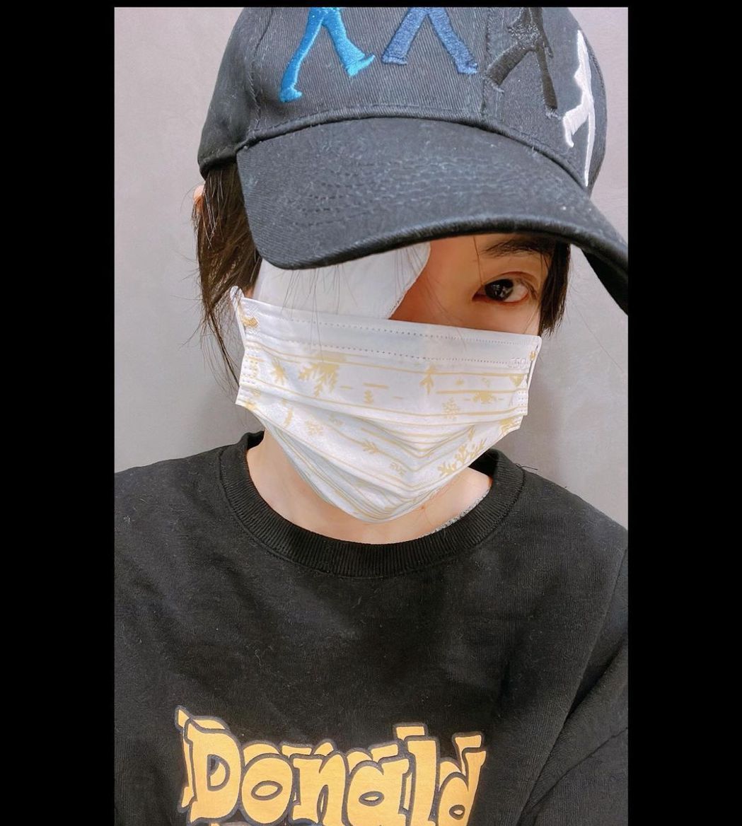 谢金燕惊变独眼龙　万年针眼大到影响视线