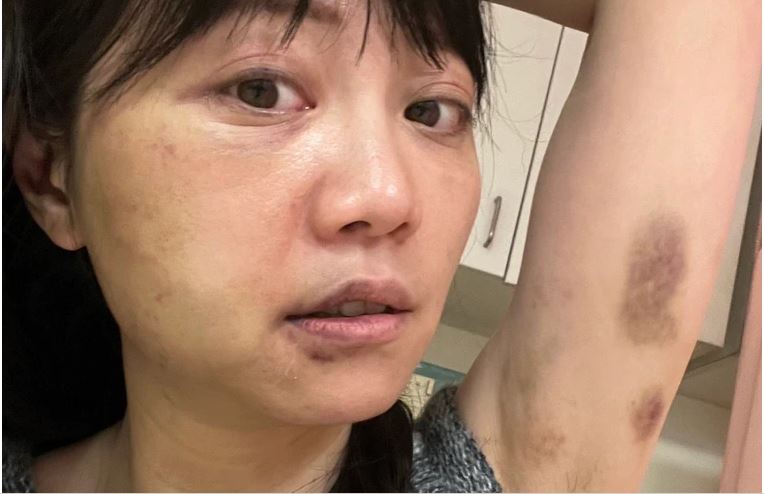 高嘉瑜哽咽说家暴「当下觉得快死了」　林男让我见识「人性最恐怖一面」