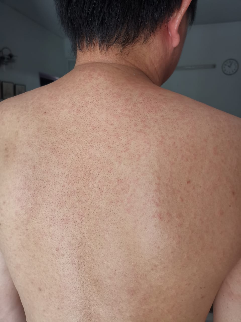 大都会/ME04头/19日见报-基金会筹款个案