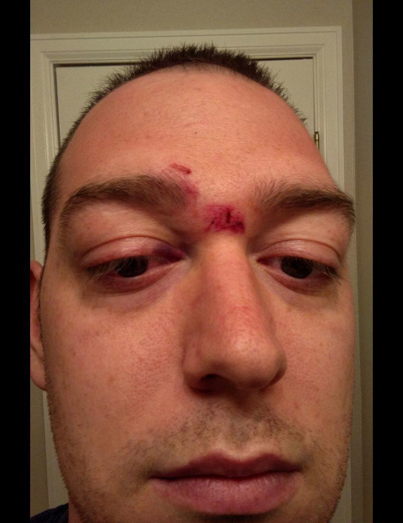 康耶维斯勾新欢跑趴失控  暴打索签名粉丝警介入调查