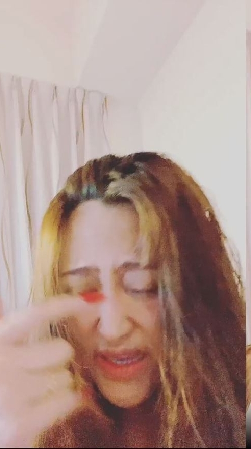 才在浴室重摔骨裂 家家生日又伤到眼睛