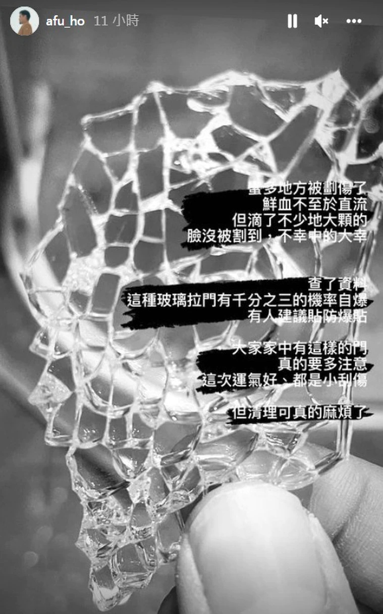 洗澡时玻璃门爆裂!鱼丁糸团长身上多处割伤