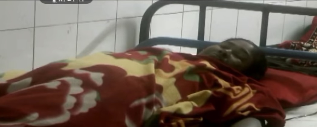 腹痛20年照X光 古董手术剪刀留肚里