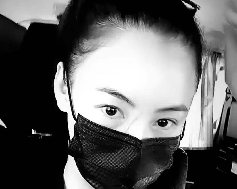 被小儿子Marcus抓伤脸伤口超长 张柏芝自称“刀疤张”