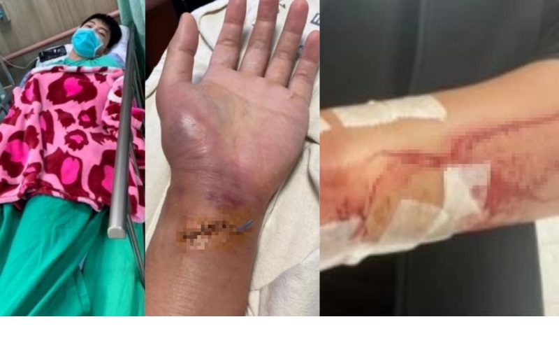 鸣笛提醒车身太近惹怒路霸 台男14声对不起仍遭砍溅血