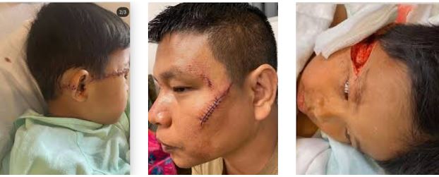 仇恨犯罪刀伤亚裔家庭 男子认罪或判终身监禁