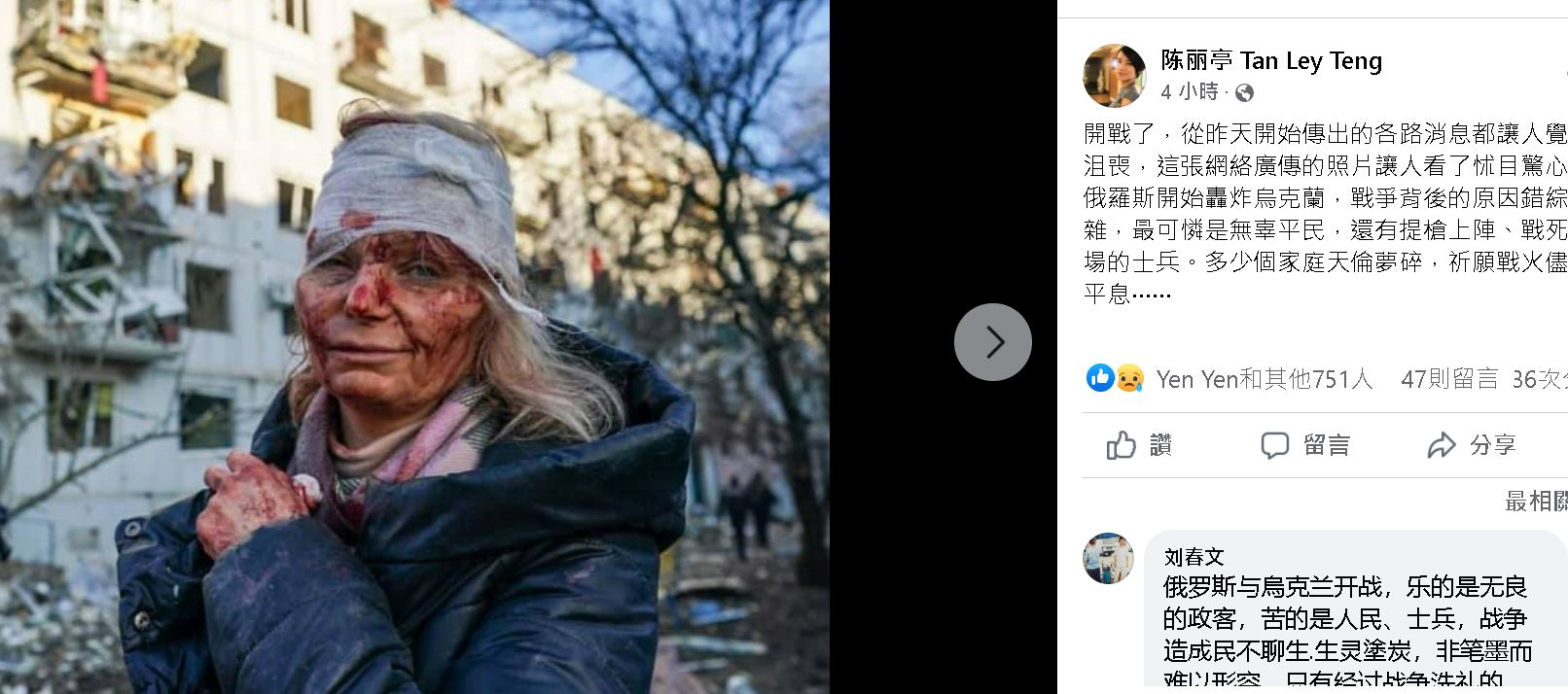  俄乌开战老百姓最伤　​艺人痛心：可以不要打仗吗