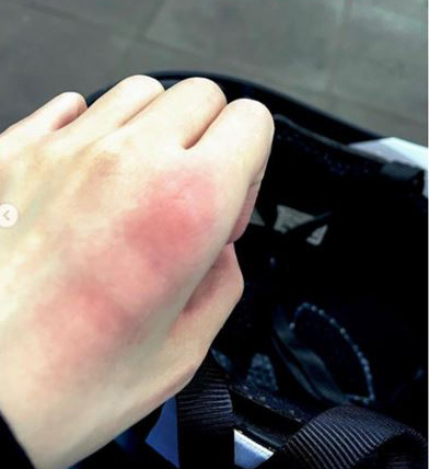 Yumi@By2又进医院 