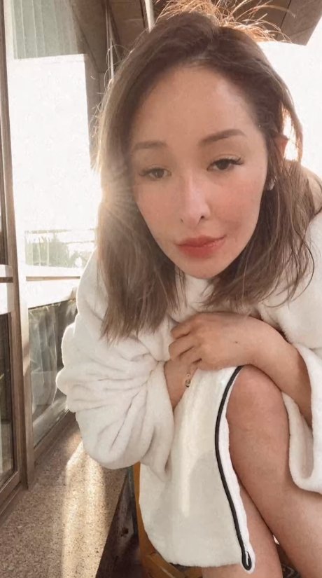 露右脸伤疤“像少一块肉” 萧亚轩:可回到左脸吗?