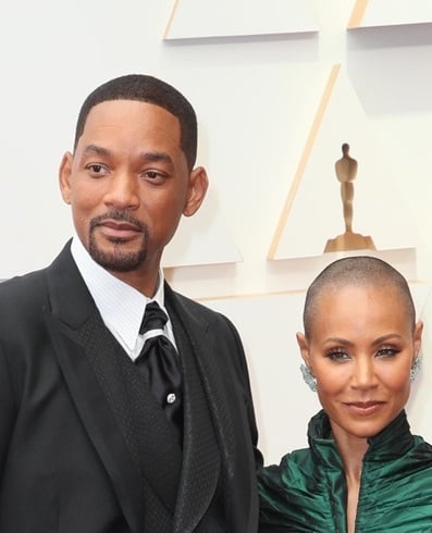 韦尔史密夫爱妻患有鬼剃头 要如何判断症状?