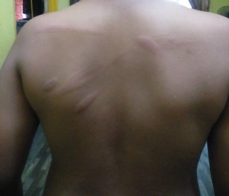 为看清白板要同学摘下宋谷·11岁男童遭宗教老师狠鞭后背