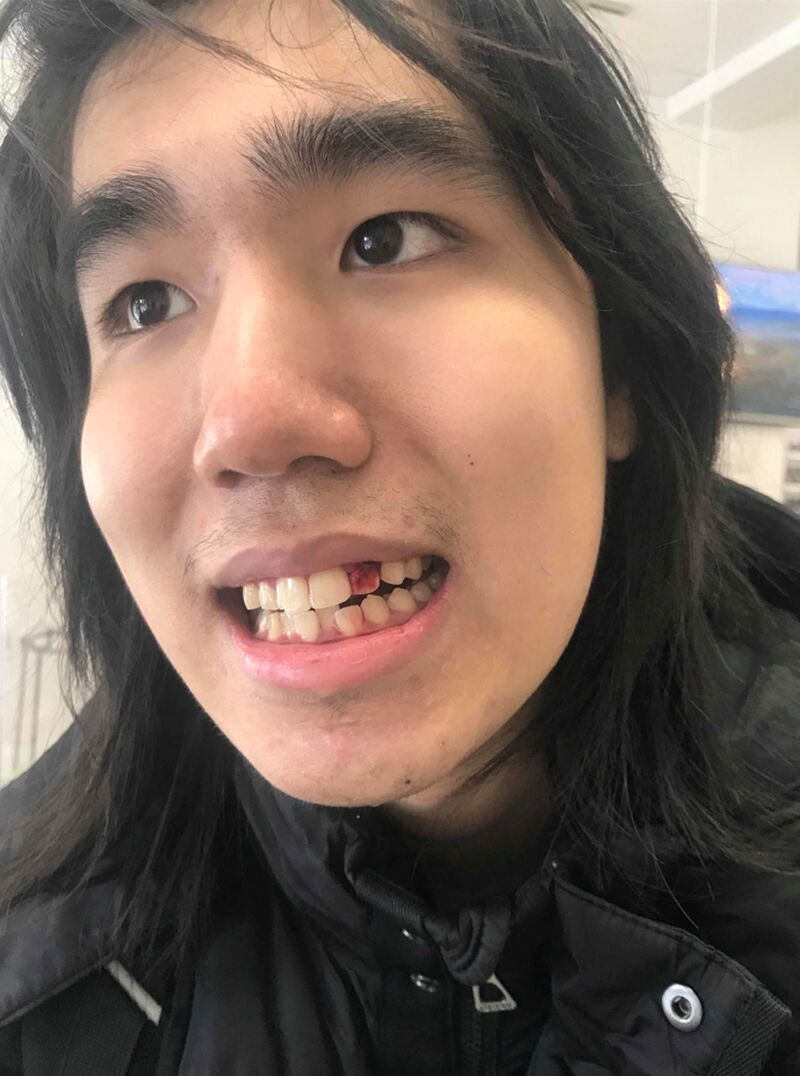 加拿大亚裔女子被肢解 尸块装垃圾袋丢路边 儿子被捕