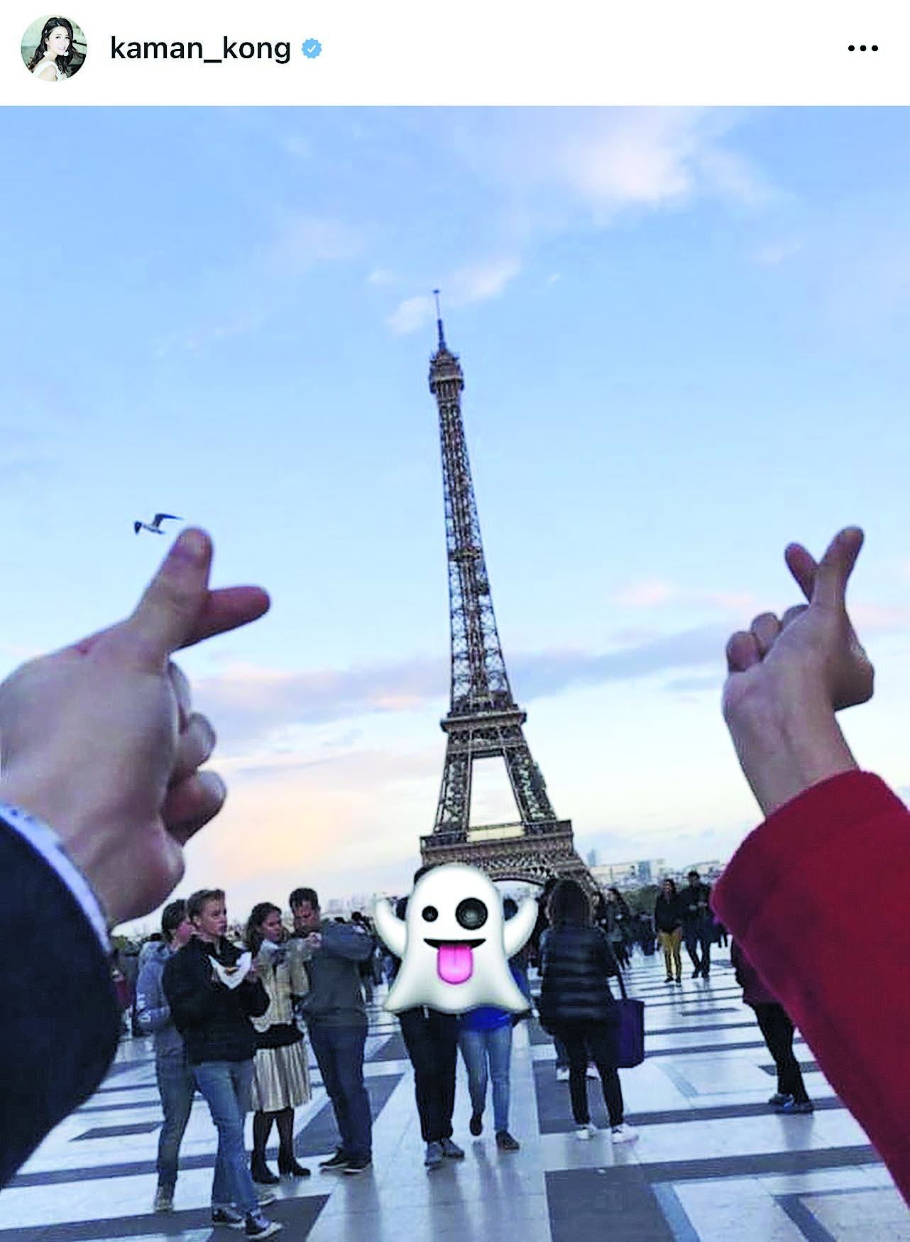 失魂跌伤脚需持拐杖 江嘉敏不为情伤自残