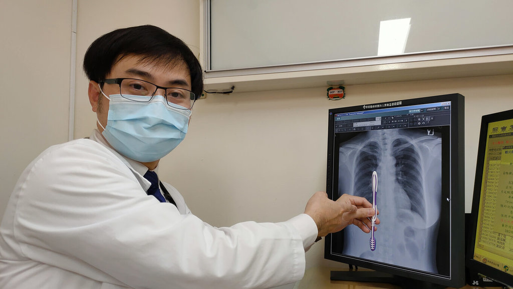 妇女赶上班误吞18公分牙刷 医护傻眼以为听错做胃镜取出