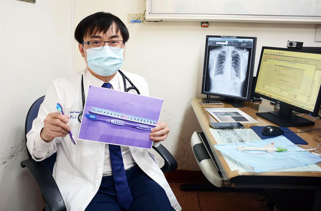 妇女赶上班误吞18公分牙刷 医护傻眼以为听错做胃镜取出