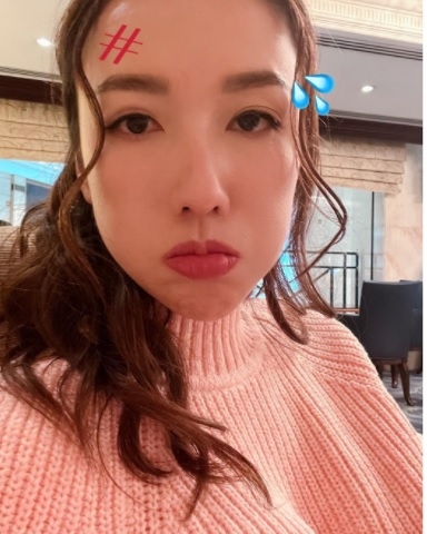 李施嬅免疫系统出问题致眼疾 停工接受治疗