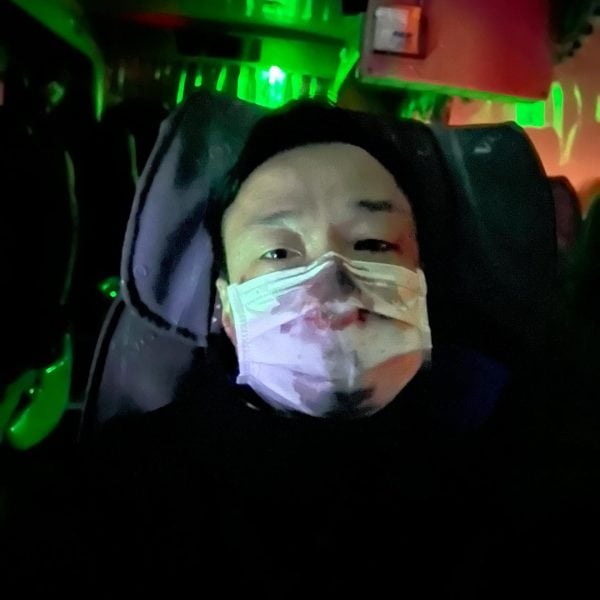 王喜曝拒止血真相  晒黑白照被骂翻